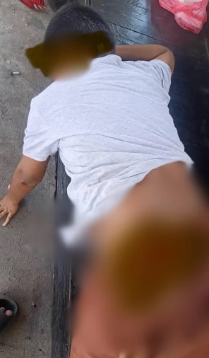 13岁男孩被狗咬伤致截肢 可恶狗主不认是主人!