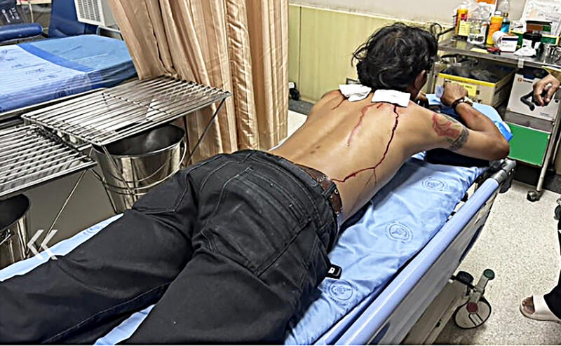 **已签发**柔:狮城二三事:2狮城客游泰被指未结账,保安劝阻称遭攻击