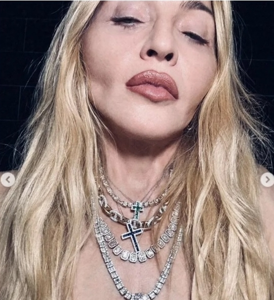 样貌不继进化惹议 麦当娜双颊凹颧骨凸