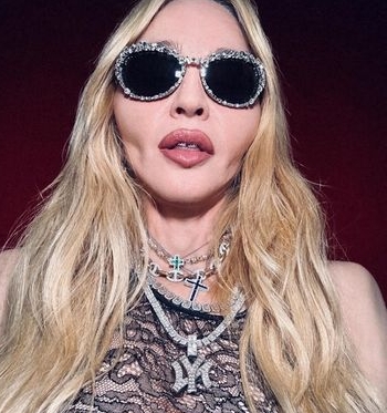 样貌不继进化惹议 麦当娜双颊凹颧骨凸