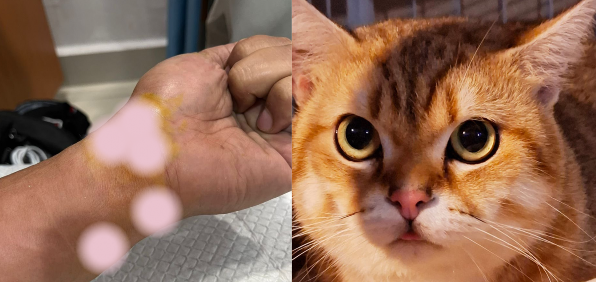 被宠物猫咬穿手腕皮肤 医疗费竟达RM17000!