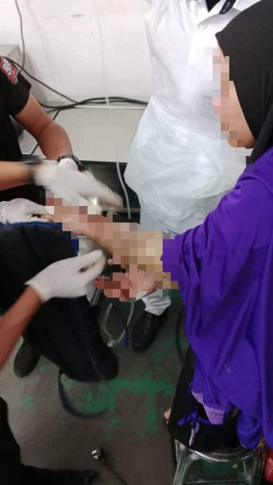 (已签发)柔:面团压片机器“咬”手,女员工左手多处骨折