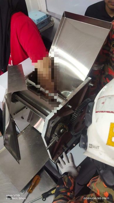 (已签发)柔:面团压片机器“咬”手,女员工左手多处骨折