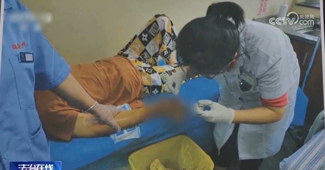 女子超市捞鱼被刺致八级伤残 医生提醒：这些海鲜可能夺命 