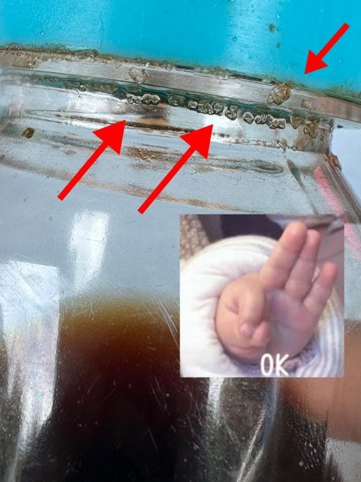 小心酱油瓶内的白点 营养师:菌落?盐粒?要分清!