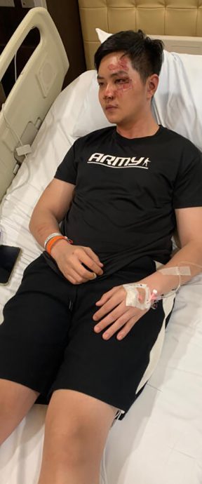 *已签发*柔:狮城二三事:疑酒后与人起口角 狮城男子遭打滚下梯