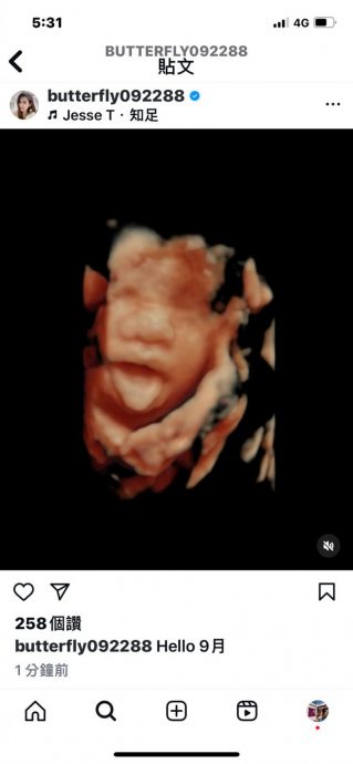 恺乐消失4年突宣布当妈!罗志祥经纪人回应了