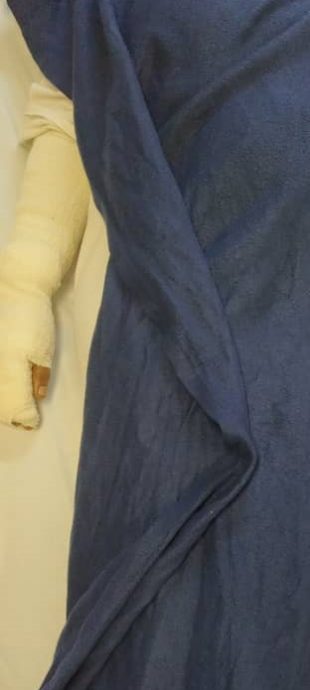 (已签发)柔:三合港小贩中心煤气泄漏爆炸,女摊主头与手受伤脸熏黑 (已签发)柔:三合港小贩中心煤气泄漏爆炸,女摊主头与手受伤脸熏黑