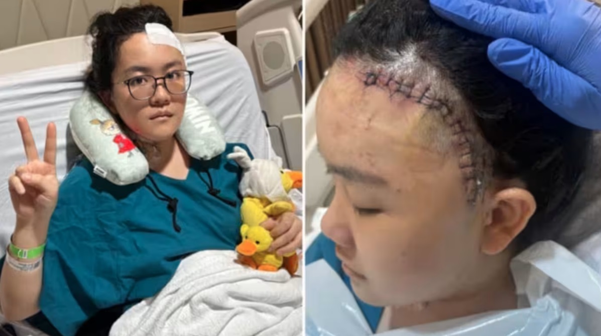 (已签发)柔:狮城二三事:26岁女子突然头剧痛 被诊断脑血管破裂引发中风