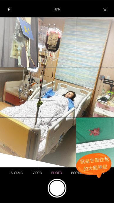 台湾女星紧急返台动手术 手术输了2轮血才动刀