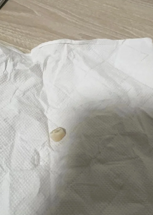 男子后悔躺着玩iPhone “门牙竟被砸断了!”