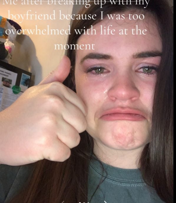 分手后失忆再续前缘 但这不是狗血剧情