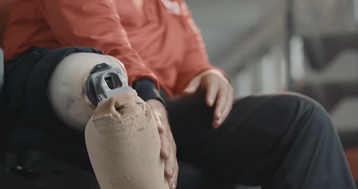 视频|“他超车害我没了一条腿” 邮差悲痛：不能游泳了！