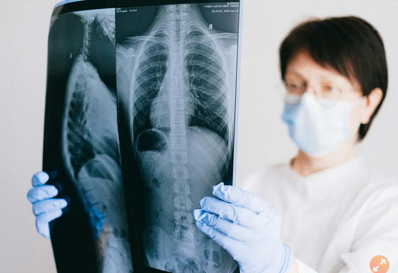 避免癌症“三冠王”上身 出现这些症状要注意