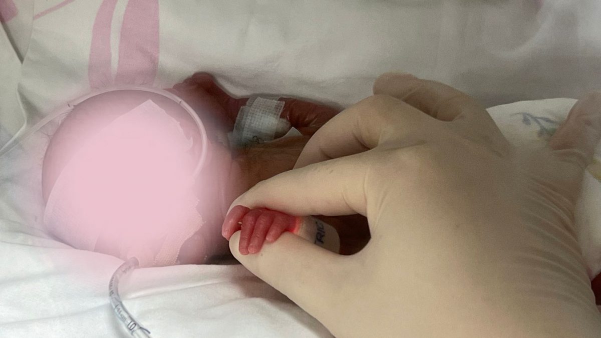 体型比矿泉水瓶还小 胎龄仅22周早产儿获救出院