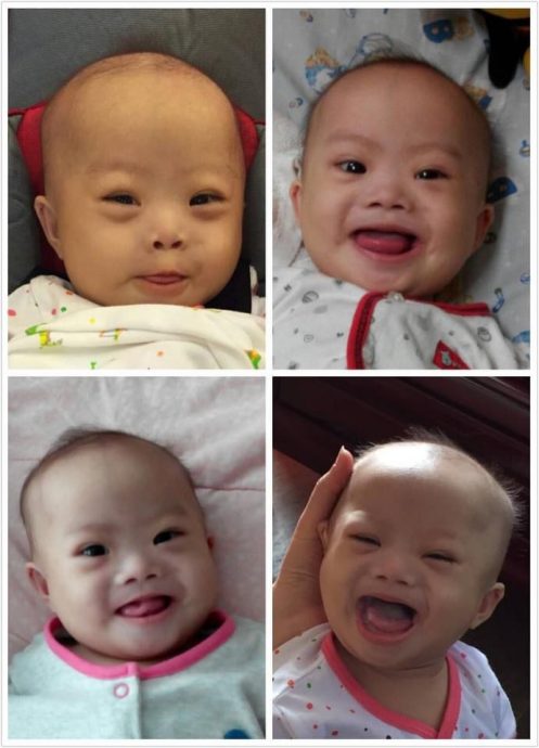 郑立慷：一家人携手了解爱护 家有特殊儿从心规划