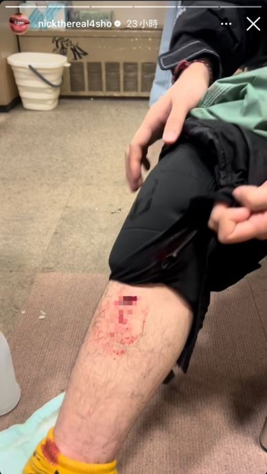 周汤豪滑雪惊传意外 伤口深可见骨超惊悚