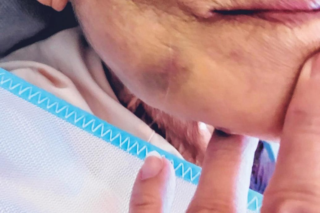 *已签发*柔:狮城二三事:女佣涉对九旬嬷动粗 猛晃拖拽还掐颈