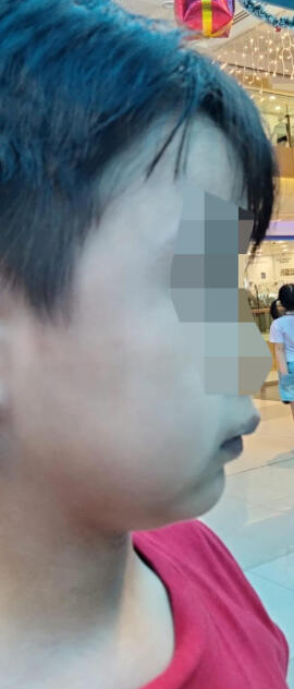 (已签发)柔:狮城二三事:家长申诉:儿与女童起争执 遭对方父亲掌掴