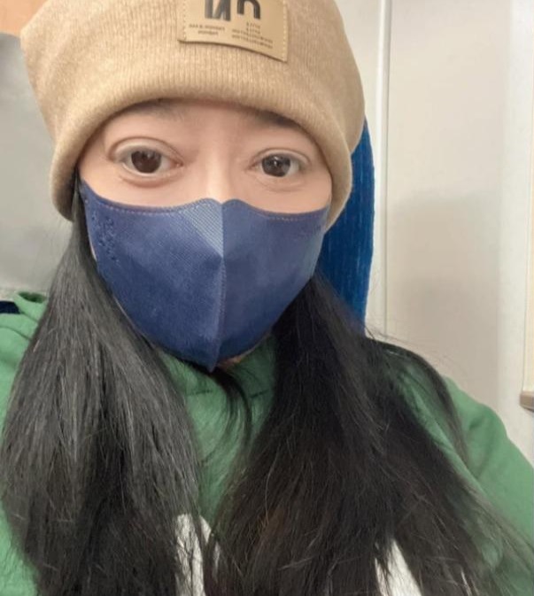  与歌神合唱成名女歌手染怪病 几近毁容崩溃：怎么活