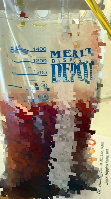 吴忻熹抗癌期间心脏及肺积水 抽1公升血水仍不改幽默