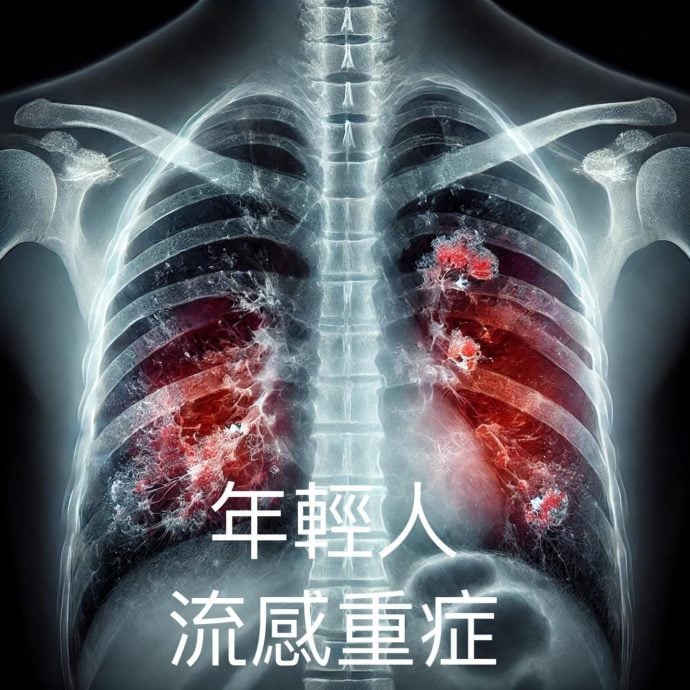 大S因流感并发肺炎去世！医生提醒年轻人勿轻忽