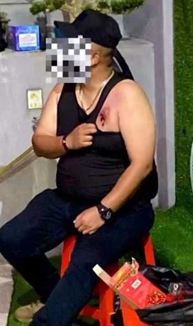 放烟花庆天公诞出意外 1人胸口被击中3车炸损