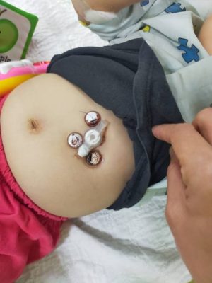 暖势力/黎辉莉/第二届“孩是爱你”征文比赛