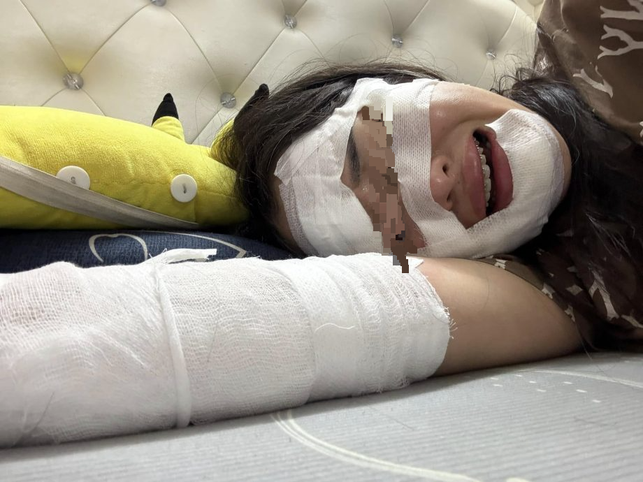 视频|生日会氢气球变火球 寿星女半张脸烧伤