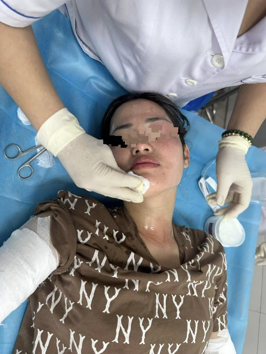 视频|生日会氢气球变火球 寿星女半张脸烧伤