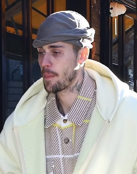 贾斯汀比柏惊变流浪汉? 暴瘦走样惹忧