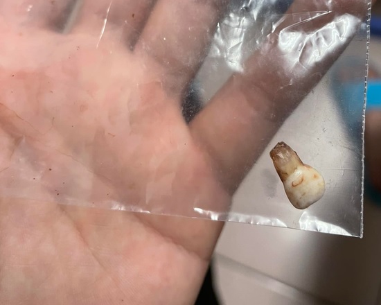 9月大女婴遭强压“哄睡”窒息亡 僵硬3小时没人理