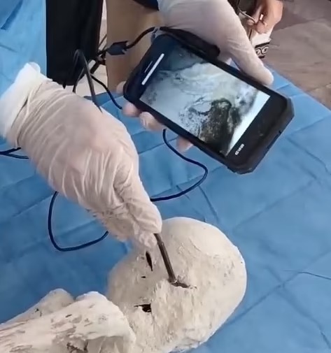 拼盘/科学家确认秘鲁“三指木乃伊”100%真实