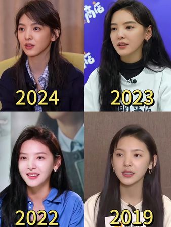 章若楠10年前“婴儿肥”照被挖　颜值变化遭疑微整