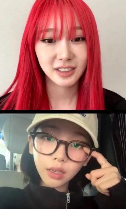 ​冒险演出直呼对不起医生 Karina曝眼角膜受损