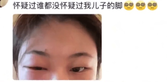 初生宝宝小脚丫有毒 34岁女星磨蹭被毁容