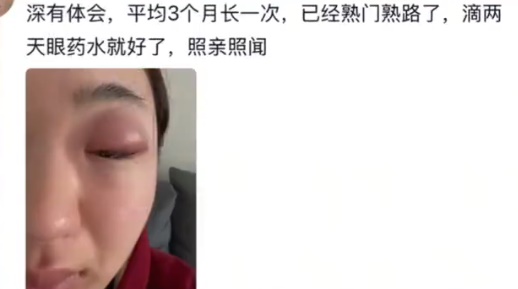 初生宝宝小脚丫有毒 34岁女星磨蹭被毁容