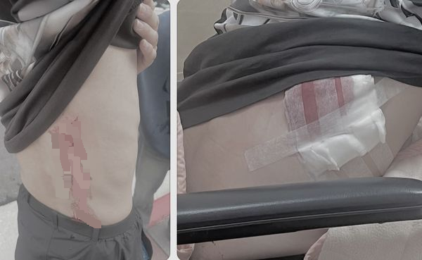 台醉男以为遭嘲笑 挥刀砍伤韩留学生