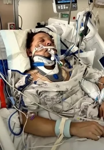 右眼看到左眼喷出!鹰眼遭铲雪车重辗:我当下已死