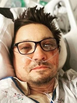右眼看到左眼喷出!鹰眼遭铲雪车重辗:我当下已死