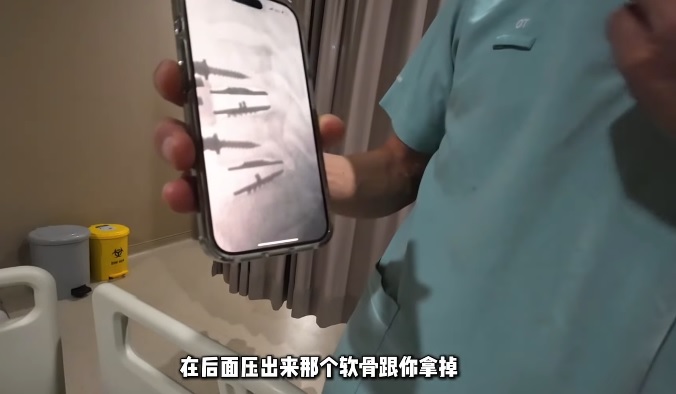 惊爆右手开始萎缩 Tomato患颈椎病动手术