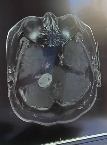 离婚净身出户扛逾2千万债 徐亨自招患脑瘤变胖