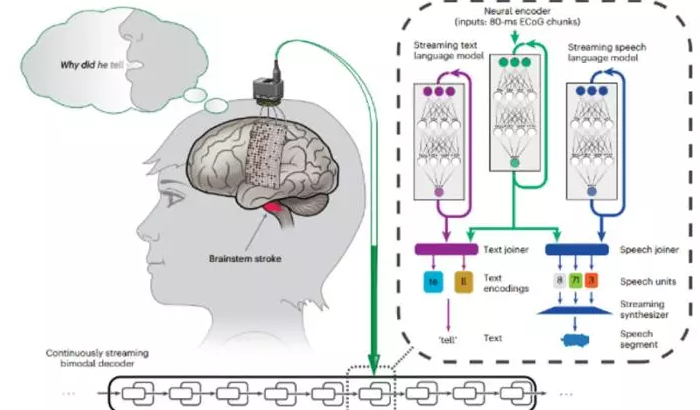 科幻成真! 科学家打造“AI脑机”令瘫痪者用意念说话