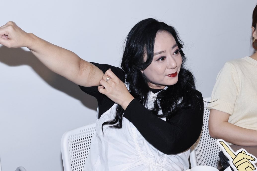 被烫伤急救疏失 高慧君惨留疤