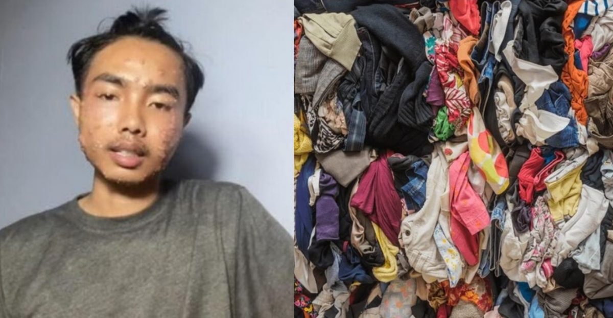 视频|穿未洗二手衣惹祸 男子染皮肤病爆红疹起小疱
