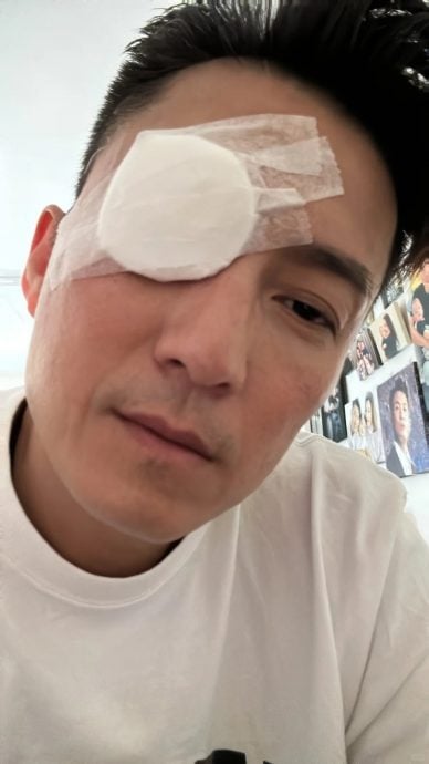 陈山聪动手术眼贴纱布 网误以为“搞抽象”