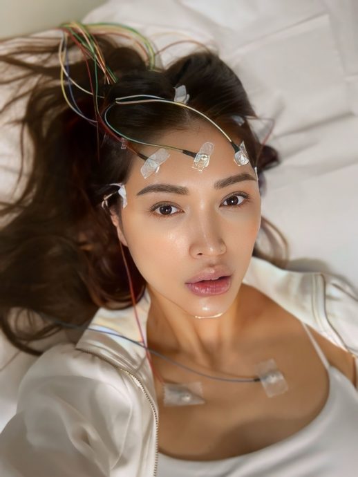 Amber Chia下巴缝10针 7颗牙齿受损喊心更痛