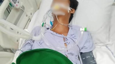 “没事 吃药回家！” 医生误判蛇咬无毒 少年翌日昏迷命危