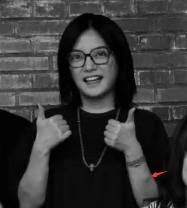 与前夫香港旧居遭拍卖 赵薇手臂惊现不明肿块