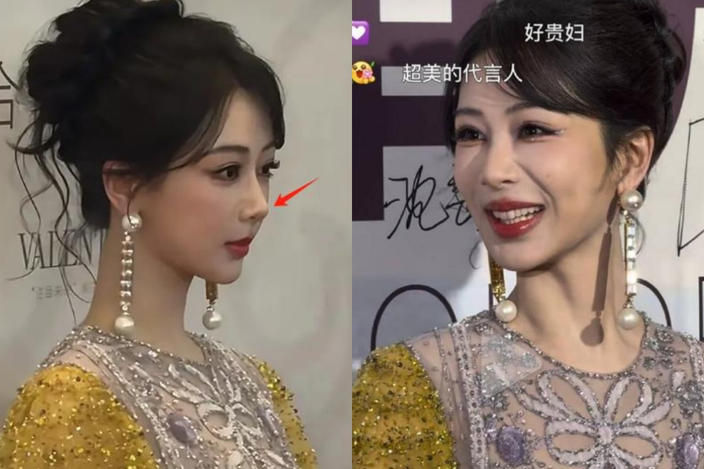 与胡歌拍新剧全网看衰 杨紫“脸僵鼻翘”遭疑整形	